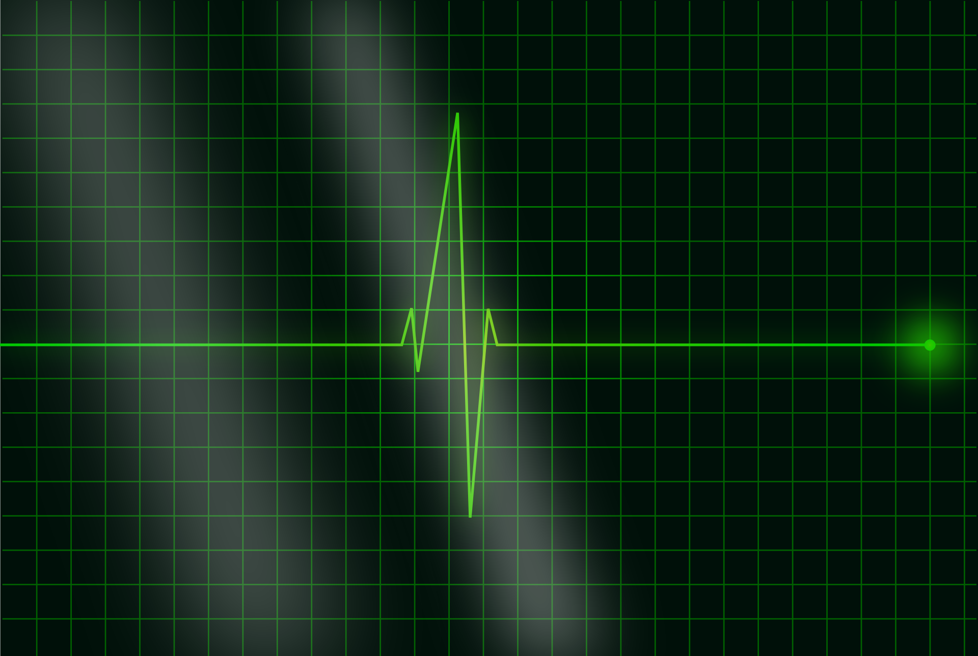 electrocardiogram-36732-3982381